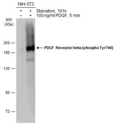 Western Blot: PDGF R beta [p Tyr740] Antibody [NBP3-13269]